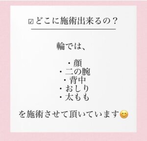 そもそもハーブピーリングってなに？