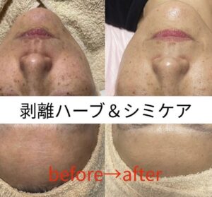 頑張って通ってくださってる方たちの 最高のbefore→after♡