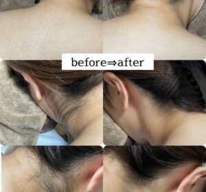 頑張って通ってくださってる方たちの 最高のbefore→after♡