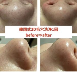 頑張って通ってくださってる方たちの 最高のbefore→after♡