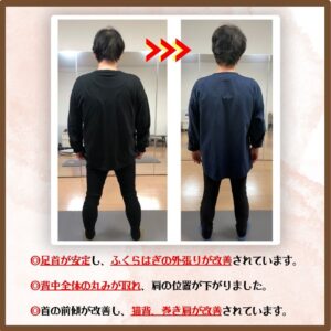 【姿勢改善　3ヶ月の変化】